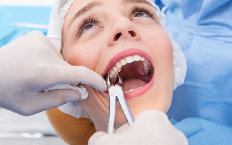 Post-Tooth Extraction