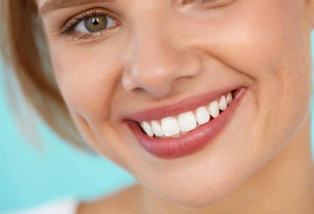 How Dental Veneers Can Transform Your Smile